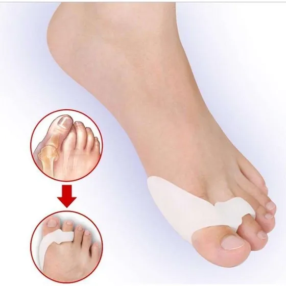 Hallux Valgus Tåspreder - Blød støtte i medicinsk silikone