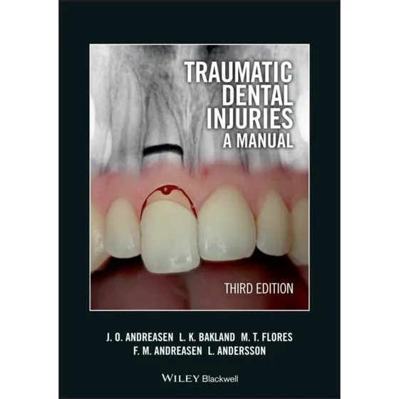 Traumatic Dental Injuries: A Manual (3. udgave)