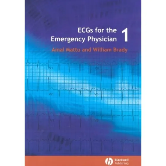 ECGs for the Emergency Physician 1 - William Brady & Amal Mattu