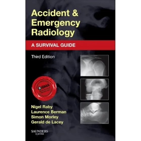 Accident & Emergency Radiology: A Survival Guide