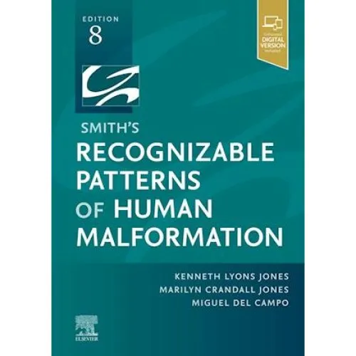 Smith's Recognizable Patterns of Human Malformation - 8. udgave
