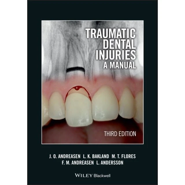 Traumatic Dental Injuries: A Manual (3. udgave)
