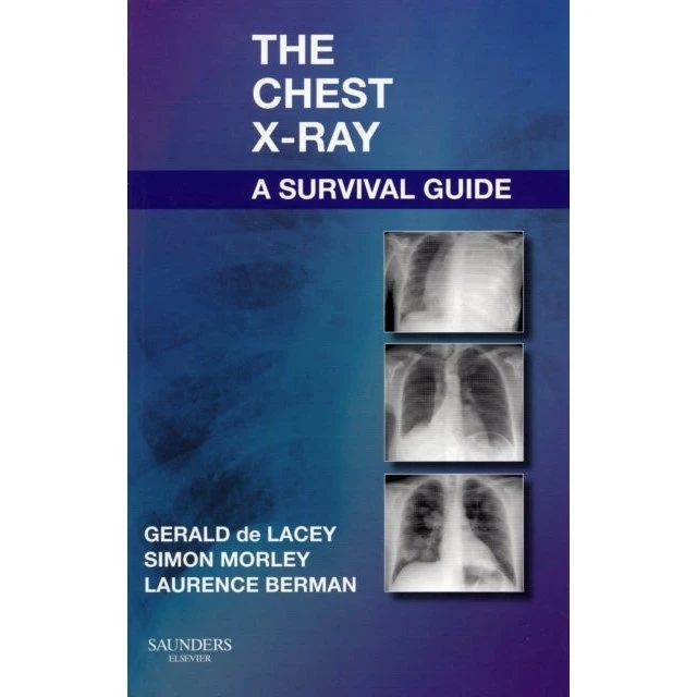 The Chest X-Ray: A Survival Guide - Gerald de Lacey m.fl.