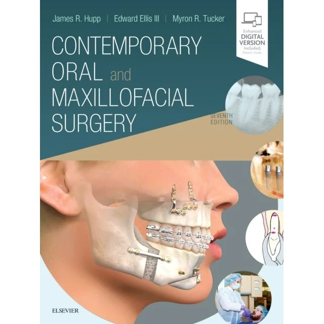 Contemporary Oral and Maxillofacial Surgery, 7. udgave